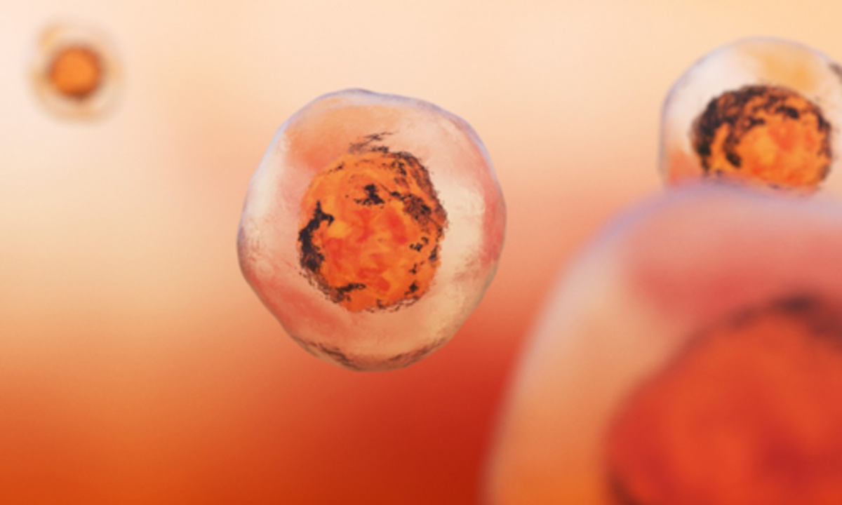 MIT-Sterol-History_1.png (Full)