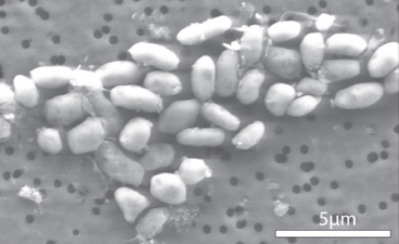 The bacteria GFAJ-1, shown here, can thrive on arsenic — a discovery that upends long-held assumptions about the basis of life here on Earth and elsewhere. Image: Science/AAAS